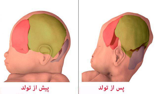 ثبت تصاویر سه بعدی از عبور نوزاد از کانال زایمانی ثبت تصاویر سه بعدی از عبور نوزاد از کانال زایمانی