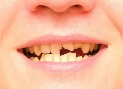 اثر باورنکردنی مسائل دندان روی فرم بدن