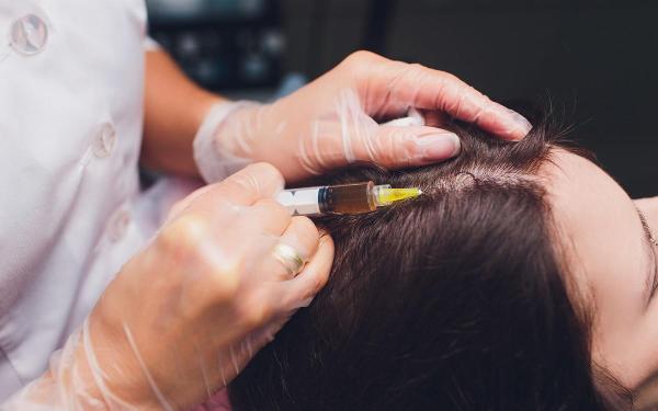 مزوتراپی مو چیست؟